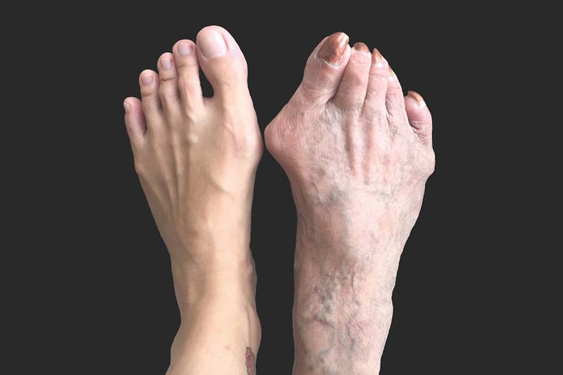 Two feet, the left one unwrinkled and with a tattoo on its ankle, and the right one more wrinkled and with a more pronounced bunion below its big toe.